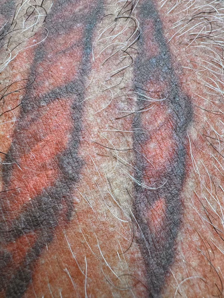 Smooth skin after permanent hair removal at Calypso Beauty, Kirkland