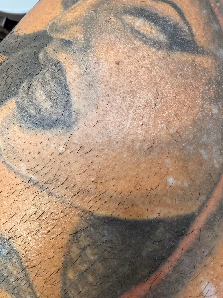Smooth skin after permanent hair removal at Calypso Beauty, Kirkland