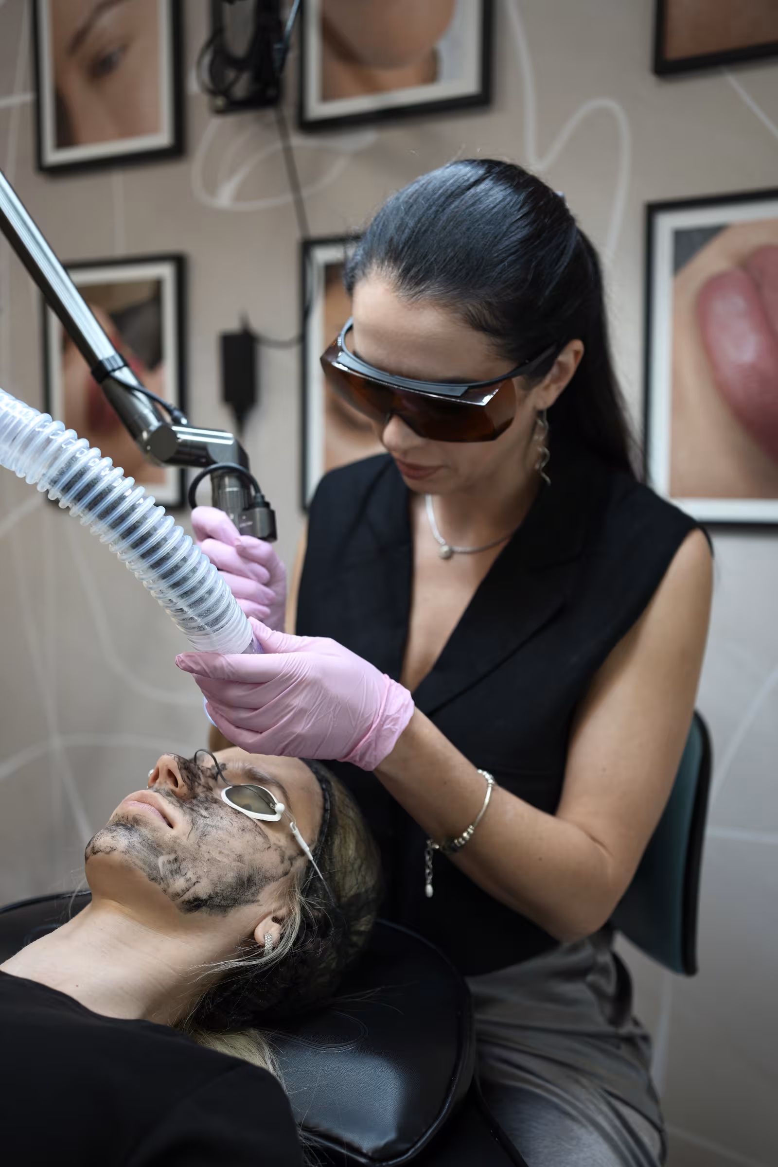 Yulia Alpeza in laser safety glasses treating a client’s carbon-masked face with the Hollywood Spectra laser at Calypso Beauty in Kirkland