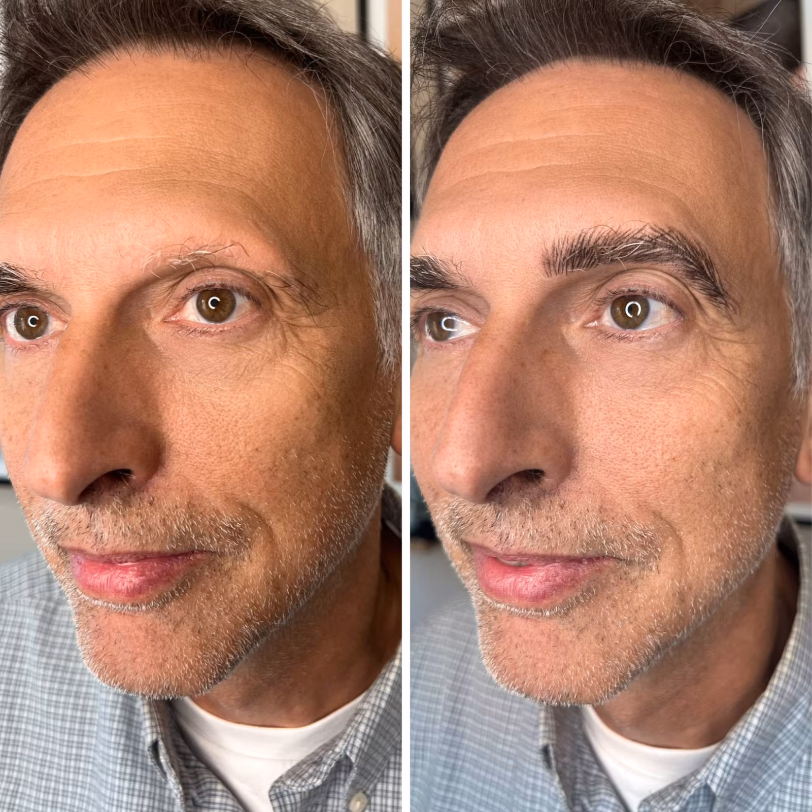 Men’s eyebrow hair replication before and after, sparse graying brows restored with natural hair strokes